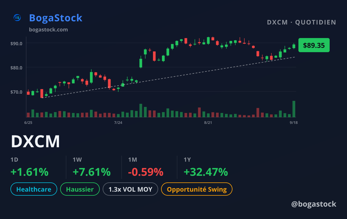 DXCM chart