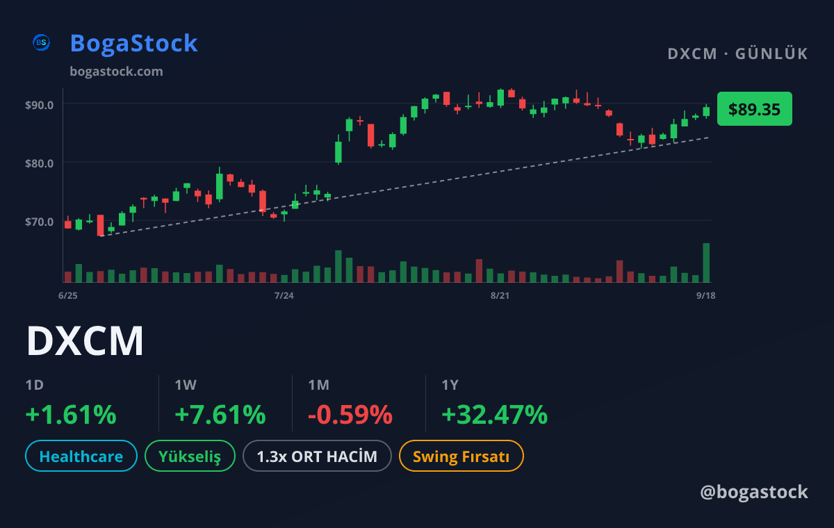 DXCM chart